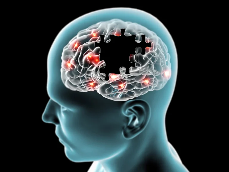 alzheimer