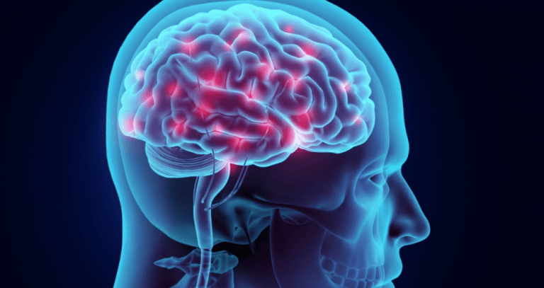 maladie-de-parkinson-le-traitement-par-neurostimulation